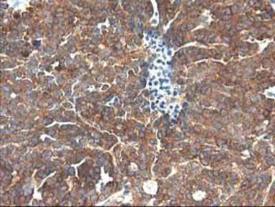 Immunohistochemistry: TFG Antibody (OTI2C3) - Azide and BSA Free [NBP2-74491]