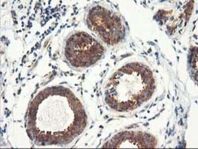 Immunohistochemistry: TFG Antibody (OTI2C3) - Azide and BSA Free [NBP2-74491]