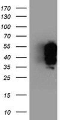 Western Blot: TFG Antibody (OTI2C3)Azide and BSA Free [NBP2-74491]