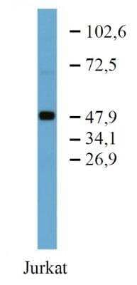 Western Blot: TFG Antibody (TFG-03) [NBP2-62212]