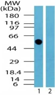 Western Blot: TFG Antibody [NBP2-24485]