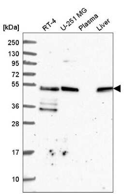 Western Blot: TFG Antibody [NBP2-56681]