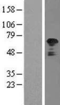 Western Blot: TFG Overexpression Lysate [NBL1-16842]