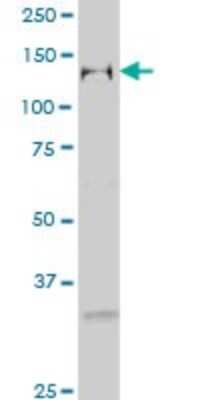 Western Blot: TFII-I Antibody (2D6) [H00002969-M02]