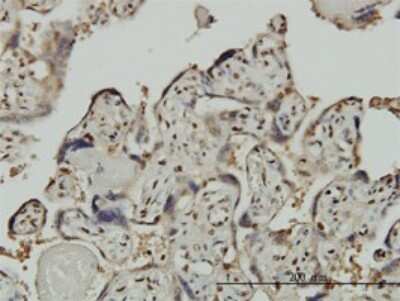 Immunohistochemistry-Paraffin: TFII-I Antibody (3E2) [H00002969-M01]