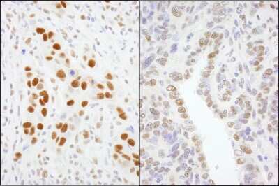 Immunohistochemistry: TFII-I Antibody [NB100-61053]
