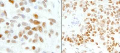 Immunohistochemistry: TFII-I Antibody [NB100-61054]