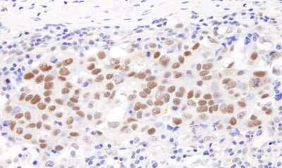 Immunohistochemistry: TFII-I Antibody [NB500-157]