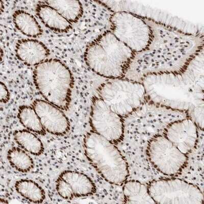 Immunohistochemistry-Paraffin: TFII-I Antibody [NBP1-90010]