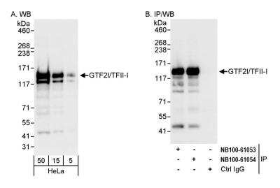 Immunoprecipitation: TFII-I Antibody [NB100-61054]