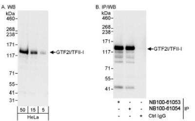 Western Blot: TFII-I Antibody [NB100-61053]