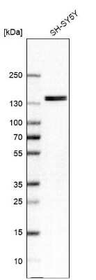 Western Blot: TFII-I Antibody [NBP1-90010]