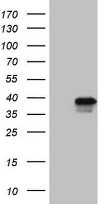 Western Blot: TFIIB Antibody (OTI1H10) [NBP2-45929]