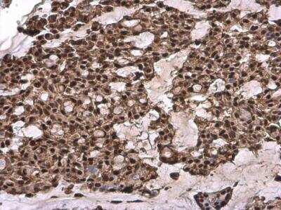 Immunohistochemistry-Paraffin: TFIIB Antibody [NBP1-32622]