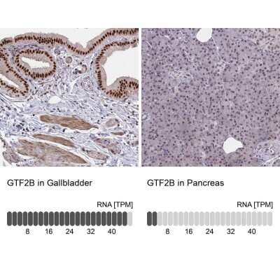 Immunohistochemistry-Paraffin: TFIIB Antibody [NBP2-34143]