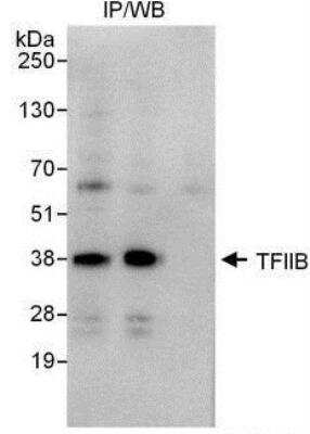 Immunoprecipitation: TFIIB Antibody [NBP1-49981]