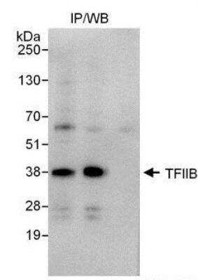 Immunoprecipitation: TFIIB Antibody [NBP1-49982]