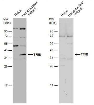 Western Blot: TFIIB Antibody [NBP1-32622]