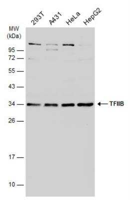 Western Blot: TFIIB Antibody [NBP1-32622]