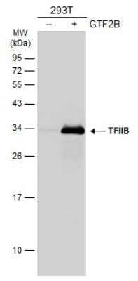 Western Blot: TFIIB Antibody [NBP1-32622]