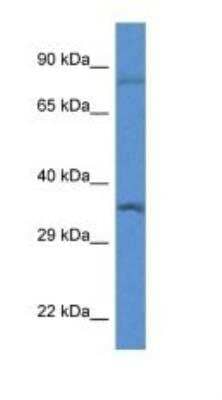 Western Blot: TFIIB Antibody [NBP1-91492]