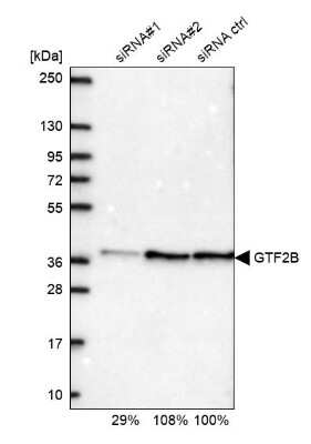 Western Blot: TFIIB Antibody [NBP2-34143]