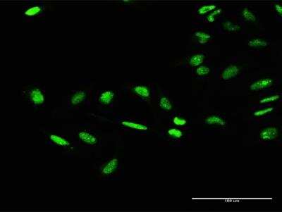 Immunocytochemistry/ Immunofluorescence: TFIIE-alpha Antibody [H00002960-D01P]