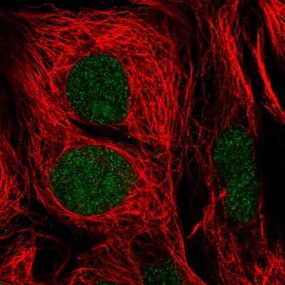 Immunocytochemistry/ Immunofluorescence: TFIIE-alpha Antibody [NBP2-57280]