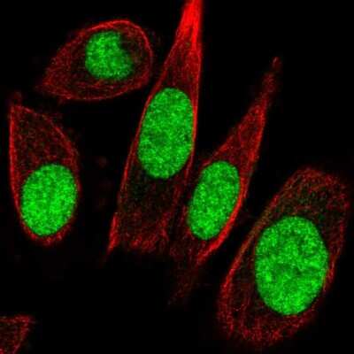 Immunocytochemistry/ Immunofluorescence: TFIIE-alpha Antibody [NBP2-58120]