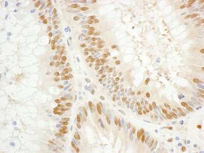 Immunohistochemistry-Paraffin: TFIIE-alpha Antibody [NBP1-46195]