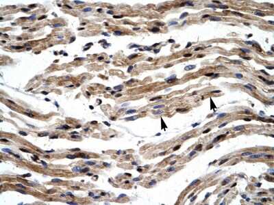 Immunohistochemistry: TFIIE-alpha Antibody [NBP3-10290]