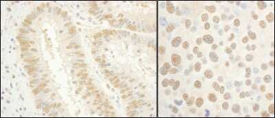 Immunohistochemistry-Paraffin: TFIIE-alpha Antibody [NBP1-46196]