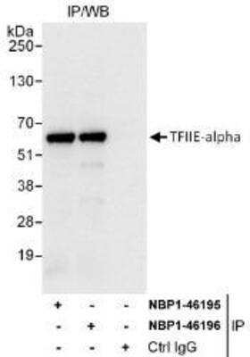 Immunoprecipitation: TFIIE-alpha Antibody [NBP1-46195]