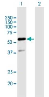 Western Blot: TFIIE-alpha Antibody [H00002960-B01P]