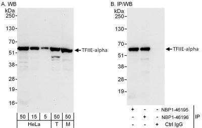 Western Blot: TFIIE-alpha Antibody [NBP1-46196]