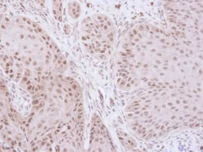 Immunohistochemistry-Paraffin: TFIIE beta Antibody [NBP1-32717]