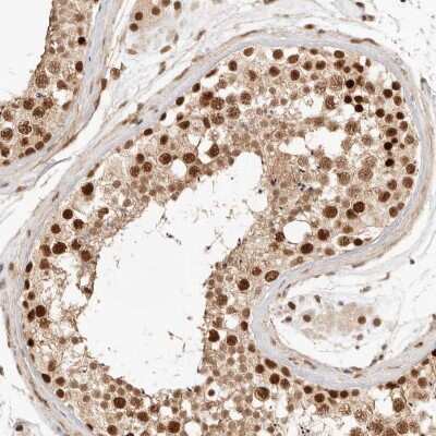 Immunohistochemistry-Paraffin: TFIIE beta Antibody [NBP1-87931]