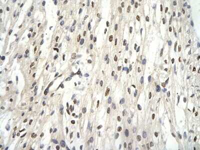Immunohistochemistry-Paraffin: TFIIE beta Antibody [NBP3-10905]