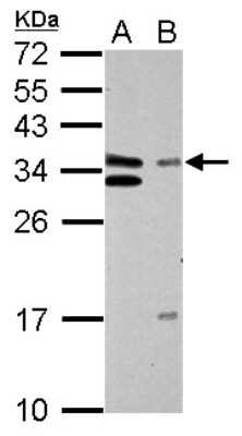 Western Blot: TFIIE beta Antibody [NBP1-32717]