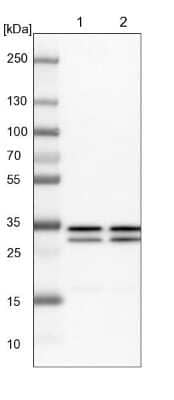 Western Blot: TFIIE beta Antibody [NBP1-87931]