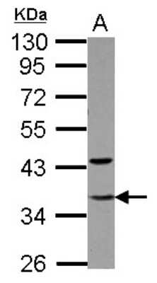 Western Blot: TFIIE beta Antibody [NBP2-20610]