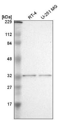 Western Blot: TFIIE beta Antibody [NBP2-55117]