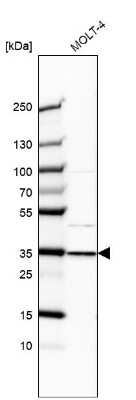 Western Blot: TFIIE beta Antibody [NBP2-55117]