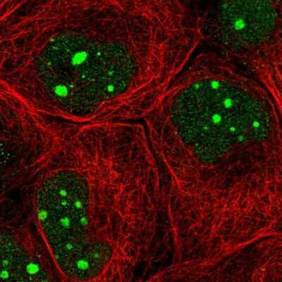 Immunocytochemistry/ Immunofluorescence: TFIIIC Antibody [NBP2-14077]