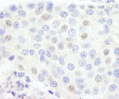 Immunohistochemistry: TFIIIC Antibody [NB100-60656]