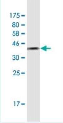 Western Blot: TFIIS Antibody (7E11) [H00006919-M01-100ug]