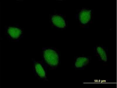 Immunocytochemistry/ Immunofluorescence: TFIIS Antibody [H00006919-B01P]