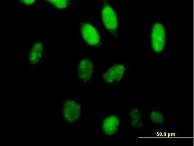 Immunocytochemistry/ Immunofluorescence: TFIIS Antibody [H00006919-B02P]