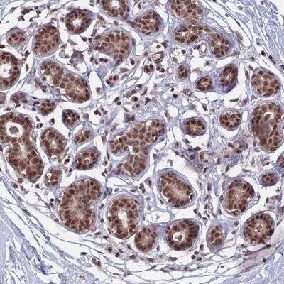 Immunohistochemistry-Paraffin: TFIIS Antibody [NBP2-13418]