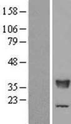 Western Blot: TFIIS Overexpression Lysate [NBL1-16756]